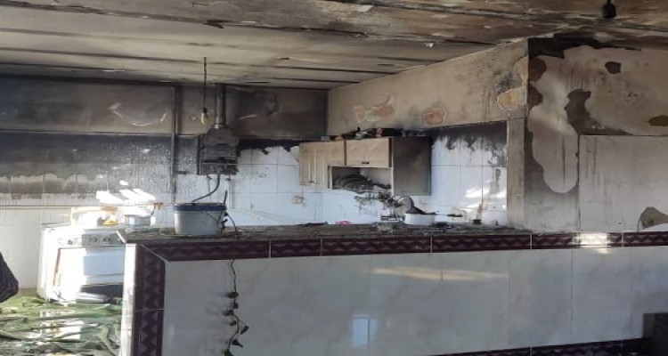 نشت گاز در روستای بابازید منجر به آتش سوزی و مصدومیت دو نفر شد