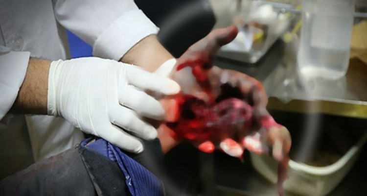 مصدومیت چهار نفر در مراسم چهارشنبه سوری در هرسین