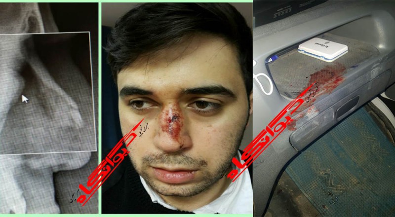 کتک کاری و شکسته شدن بینی همکار فوریت های پزشکی هرسین در حین انجام مأموریت/ به آمبولانس هم خسارت وارد شده است