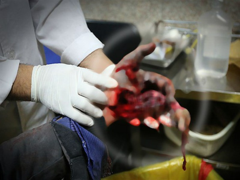 مصدومیت چهار نفر در مراسم چهارشنبه سوری در هرسین